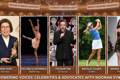 celebrities with noonan syndrome