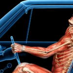 Illustration of common auto accident injury types including whiplash, fractures, and head trauma