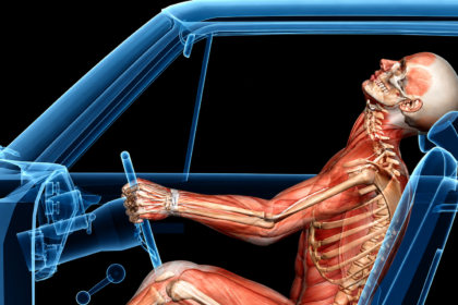 Illustration of common auto accident injury types including whiplash, fractures, and head trauma