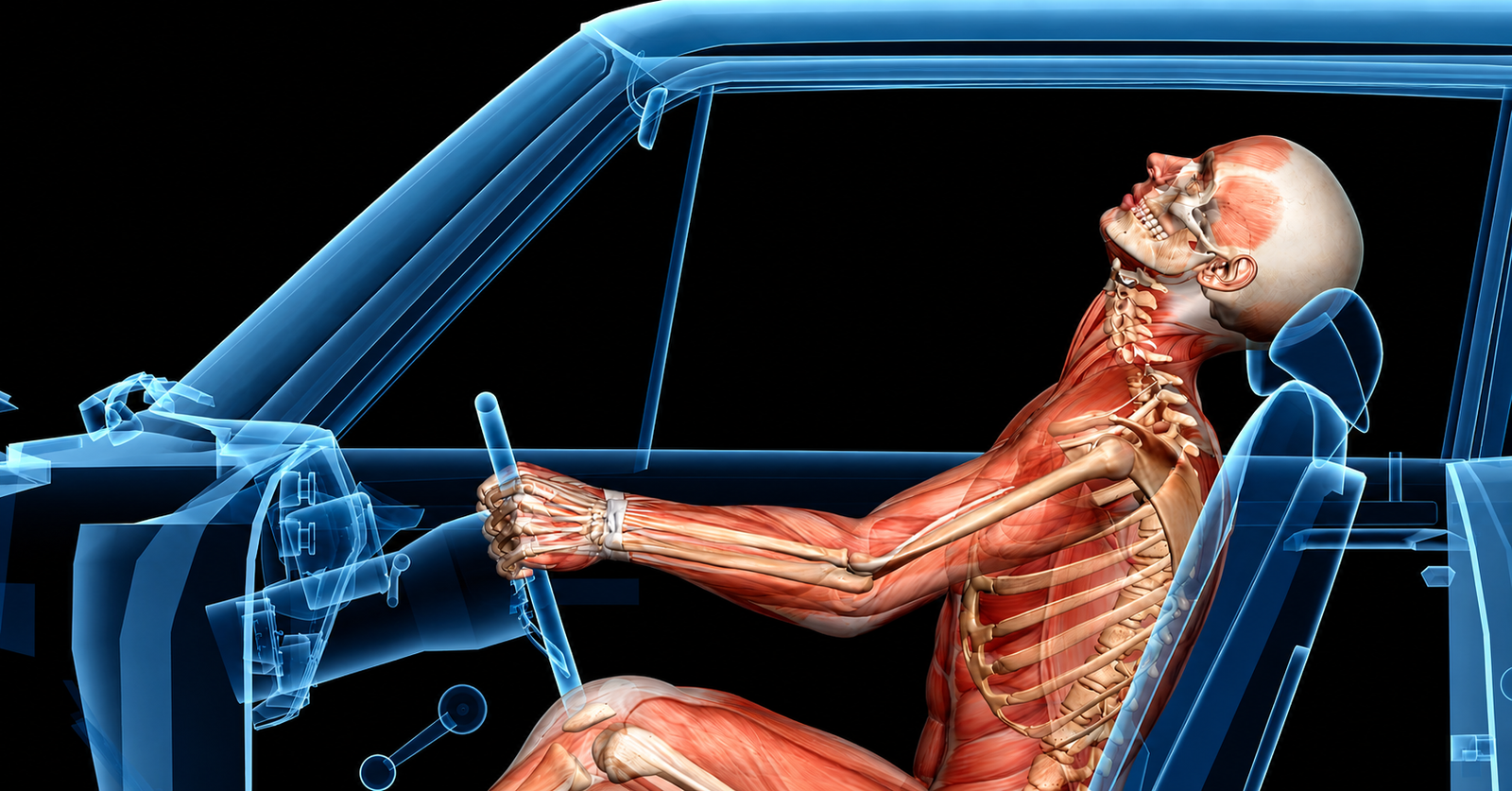 Illustration of common auto accident injury types including whiplash, fractures, and head trauma